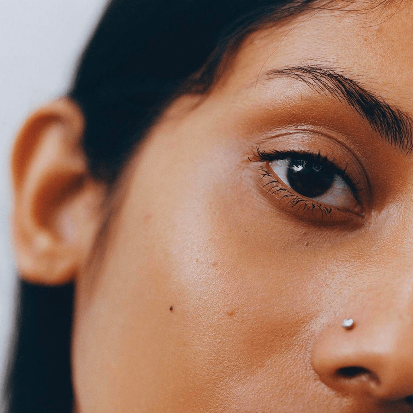How To Get Rid Of Dark Spots On Face According To Dermatologists Vogue