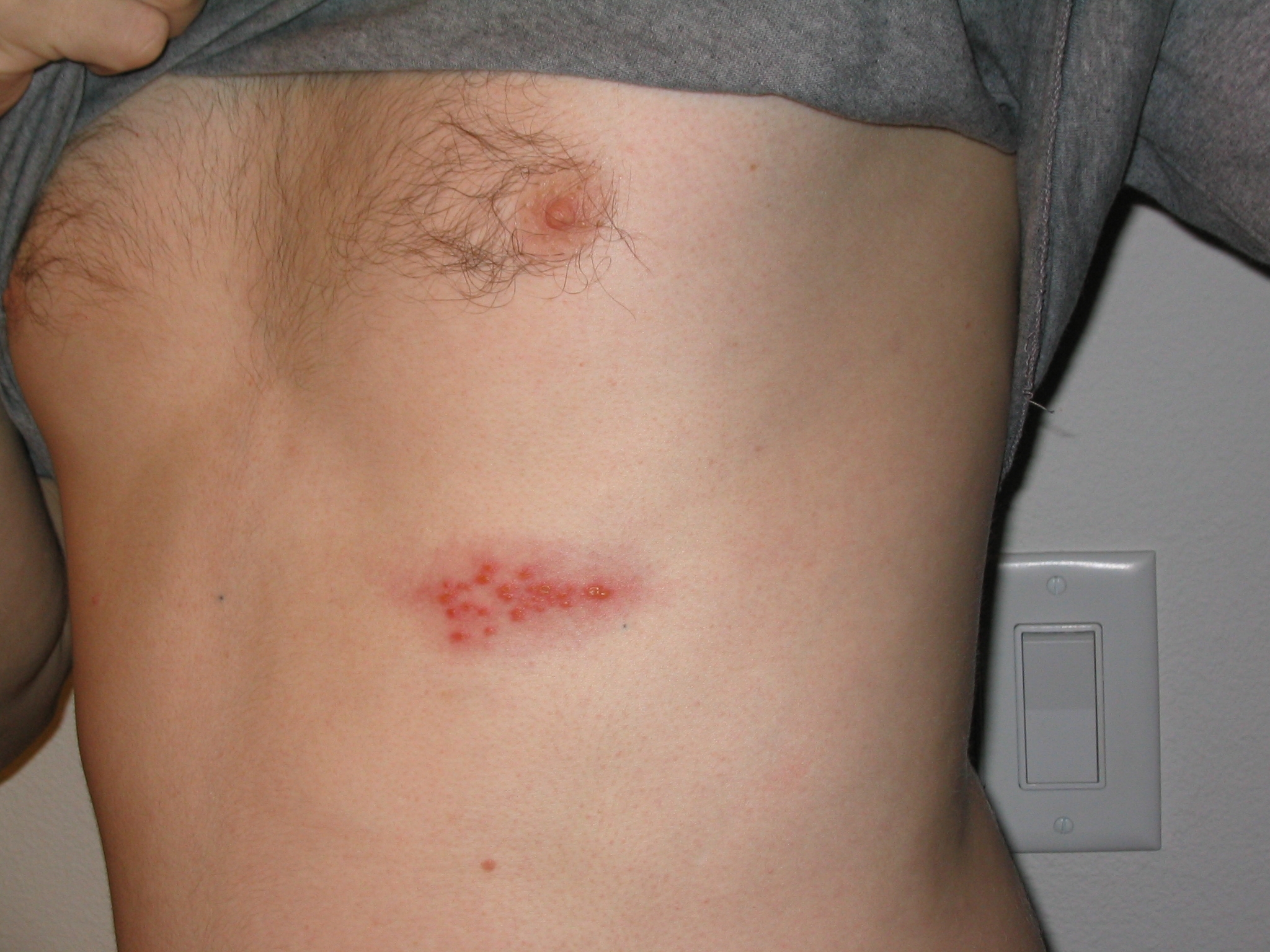 tiny red dots all over body
