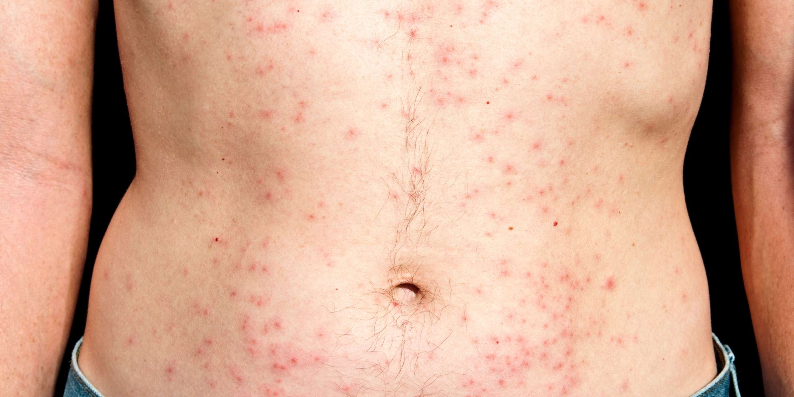 Red Dots On Skin Dr Yousefi