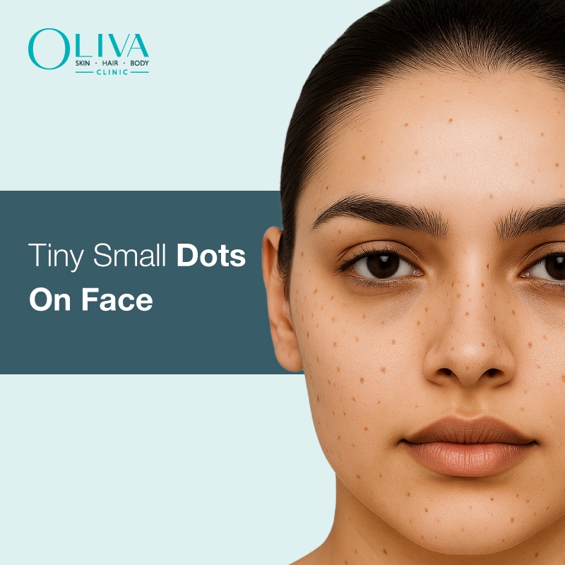 Tiny Black Dots On Face Causes Symptoms U0026 Treatment Options