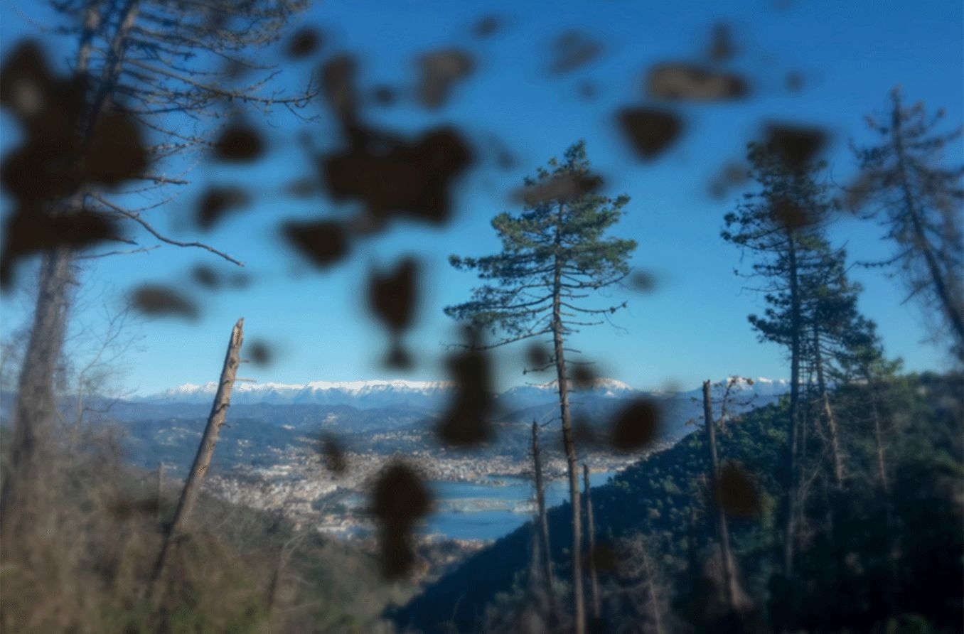 Why You re Seeing Black Spots In Your Vision